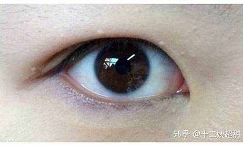 眼睛一转就有一层薄膜凸起来(眼睛往外转动)_https://www.gen-fastener.com_广期所_第1张